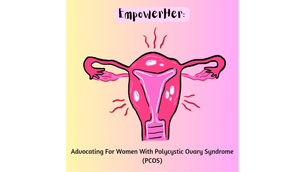 PCOS