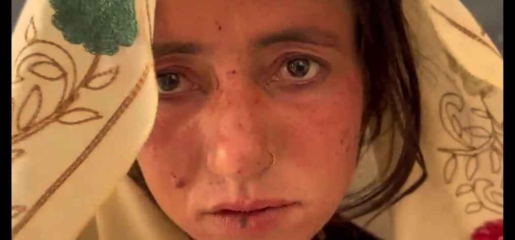 The last portrait of Gulaan Bharo taken in police station, showing visible bruises and injuries on her face after enduring domestic violence. The image reflects the physical and emotional impact of abuse.